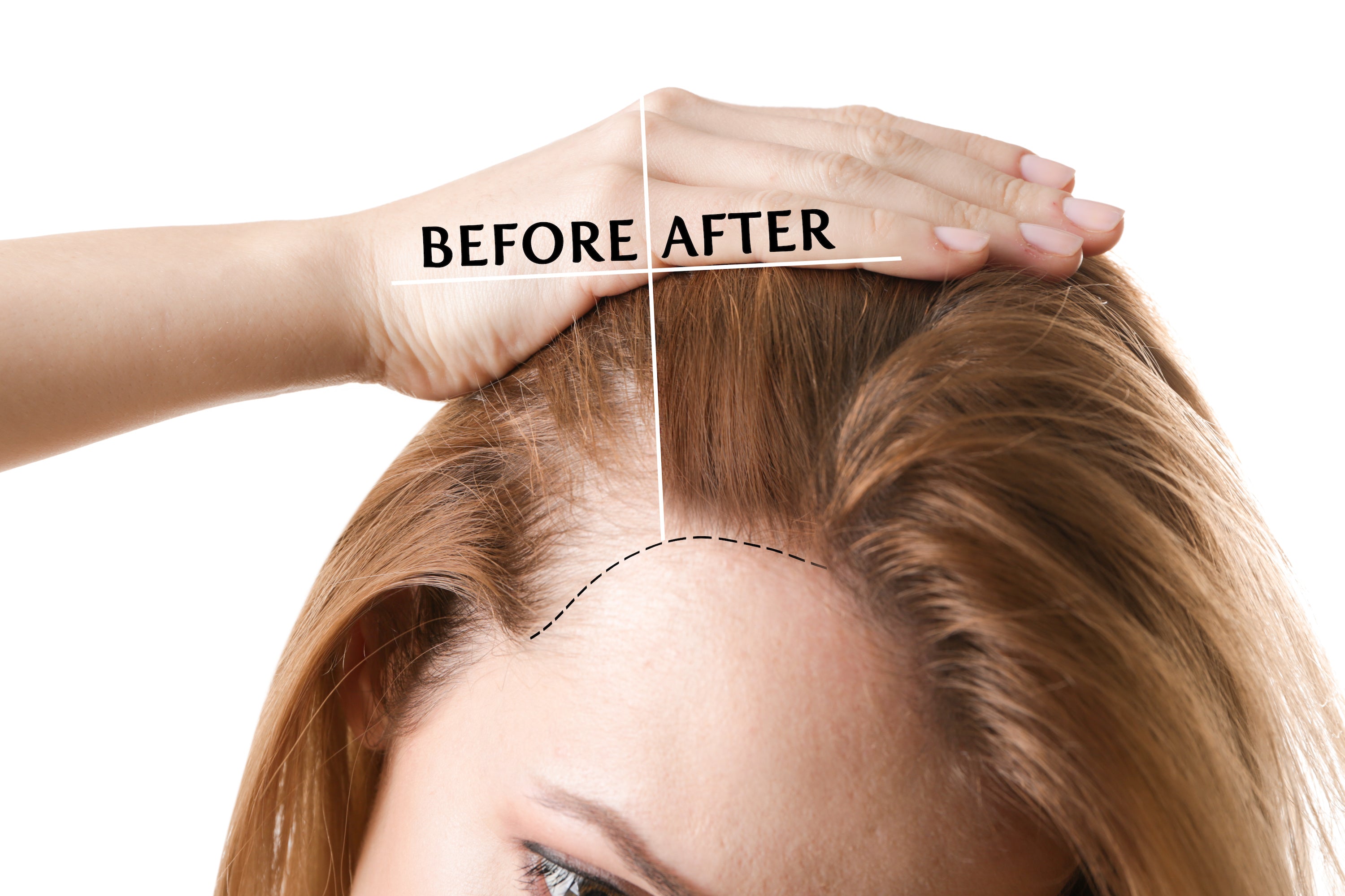 Hair Growth Oil and Thickening Scalp Treatment with Castor, Jojoba, Clary Sage, Rosemary, Nettle Extract I478